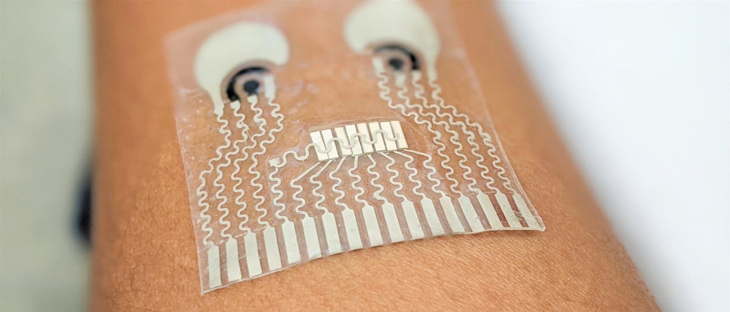 AI hydration monitoring