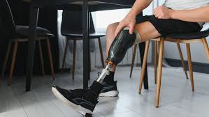 Customized Prosthetics Innovation 2025